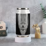 Coke Cup Medical X Ray Bone Paranasal Sinus Anatomy Jaw Skull Exam Nasal Radiologist