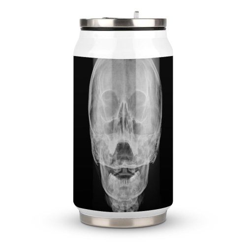 Coke Cup Medical X Ray Bone Paranasal Sinus Anatomy Jaw Skull Exam Nasal Radiologist