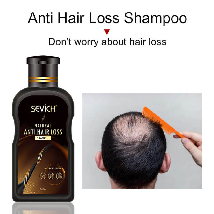 Anti-HairLoss Shampoo sevich 200ml hair loss treatment shampoo hair care shampoo bar ginger hair growth shampoo