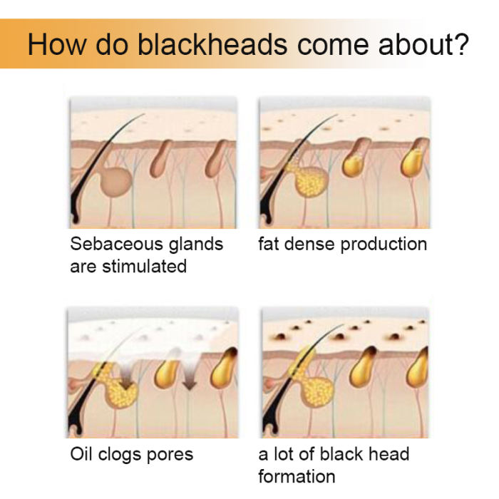Black Head Mask Sevich Black Face Mask Blackhead Remover Deep Exfoliating Peel Off Mask Mud Lasting Moisturizing Nourish Whitening Masks Women