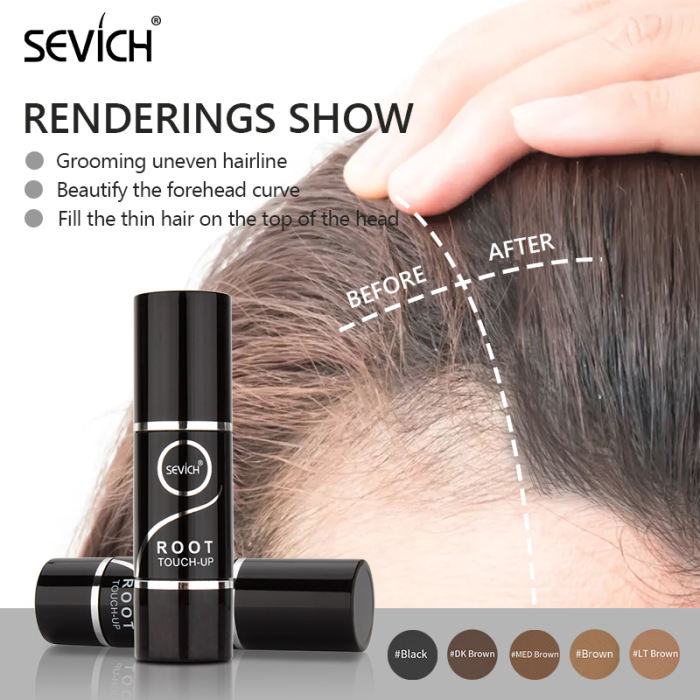 Hairline Shadow Powder Spray Concealer Up Bald Spots Thin Hair Cover, Root  Concealer, Fills In Receding Hairlines, Hair Color Powder Root Touch Up  Fill In (Brown) | Color Hair Line Modified Repair