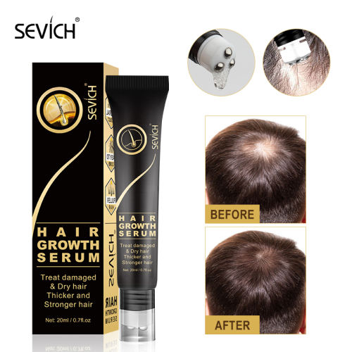 Sevich 20ml Ginger Hair Growth Oil Thickener Essence Anti Hair Loss Care Scalp Massage Roller Treatments Fast Grow Hair Serum
