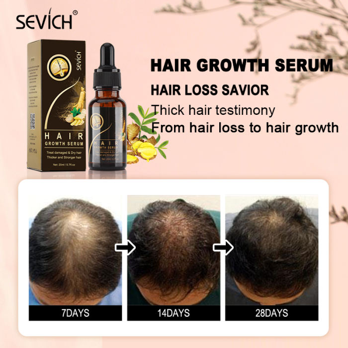 Sevich Ginger Hair Growth Serum 20ml