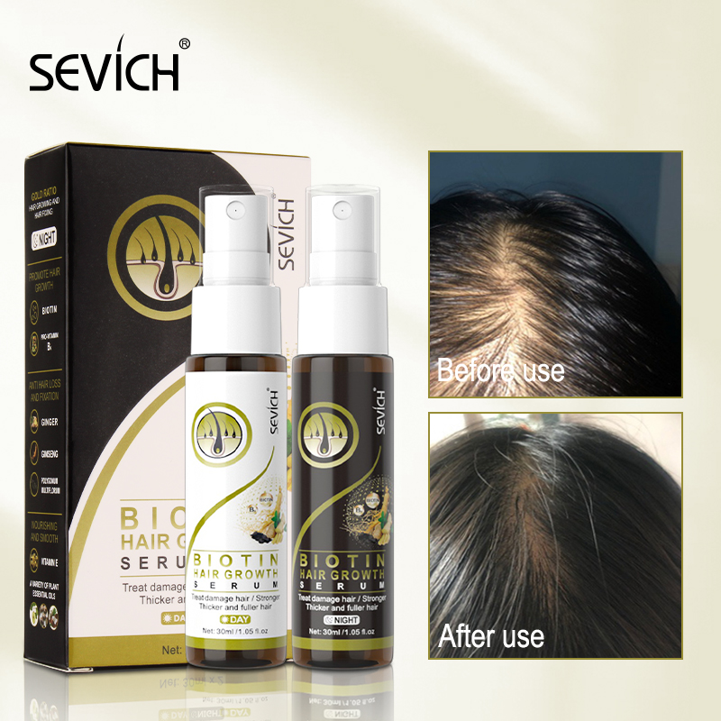 Sevich Day& Night Biotin Fast Hair Growth Serum Spray Set Ginger
