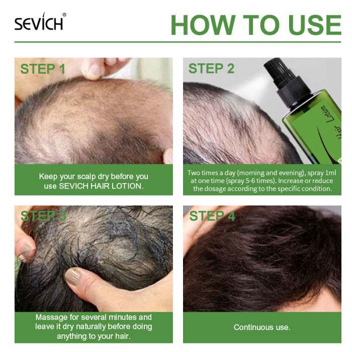 Sevich Green Plant Hair Growth Spray 120ml