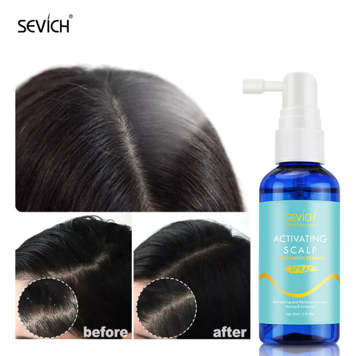 Sevich Scalp Treatment Spray Nourishing Hair 60ml 
