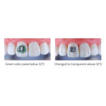 Orthodontic light cure green gel kit (standard) Bonding Adhesive