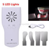 Dental Occlusal Mirror Fog Free LED Intra Oral Photo System 4 Mirrors Anti-Fog