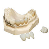 Dental Prime Multilayer High Translucency (MHT) Zirconia Block 16 shade 98x14