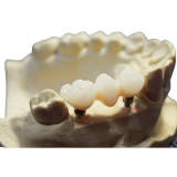 Dental Prime Gradient Multilayer (GM-3D) Zirconia Block 20 Shade 98x25
