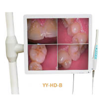 17inch dental monitor intraora camera AV and HDMI built-in Wifi (YY-HD-B)