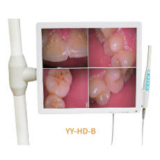 17inch dental monitor intraora camera AV and HDMI built-in Wifi (YY-HD-B)