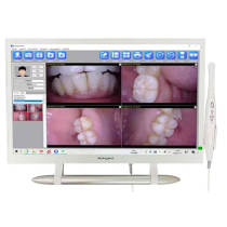 24 inch dental computer Intraoral Camera System with VGA+HDMI YF-2400P 1080P