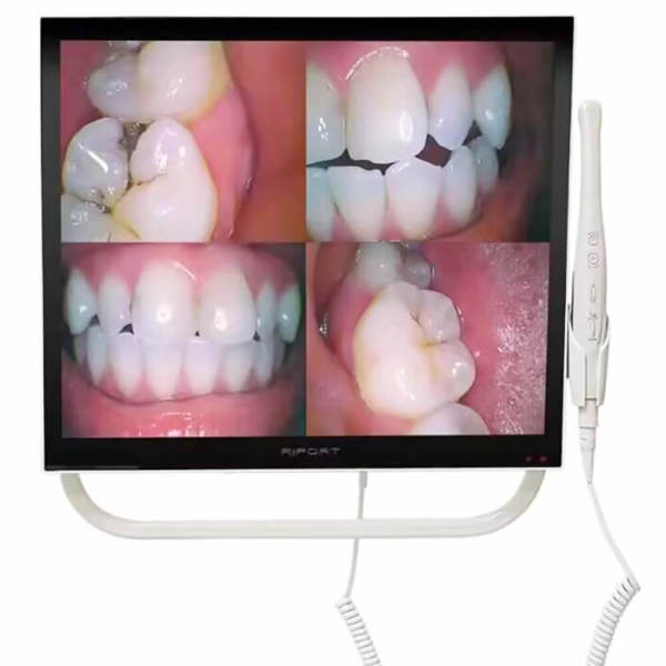 17inch dental monitor intraora camera system with armored glass (YFHD-D)