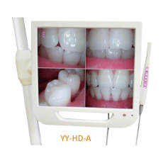 17inch dental monitor intraora camera built-in Wifi AV and HDMI (YY-HD-A)