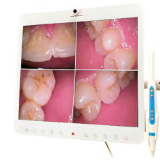 17inch white dental monitor Intraoral Camera System Built-in Wi-Fi YF1700A