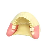 Student Practice M8026 Wisdom Tooth Extraction Model #38 #48 Impacted Teeth