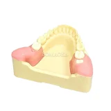 Student Practice M8026 Wisdom Tooth Extraction Model #38 #48 Impacted Teeth