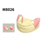 Student Practice M8026 Wisdom Tooth Extraction Model #38 #48 Impacted Teeth