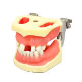 M2029 Maxillary Sinus & Mandibular Implant Model