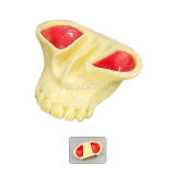 M2039 Maxillary Sinus Practice Model