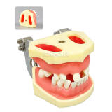 M2029 Maxillary Sinus & Mandibular Implant Model