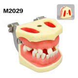 M2029 Maxillary Sinus & Mandibular Implant Model
