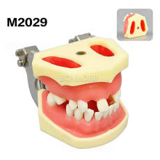 M2029 Maxillary Sinus & Mandibular Implant Model