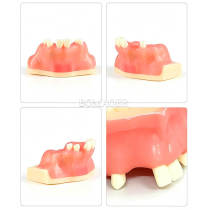 M2014 Maxillary Sinus Practice Model