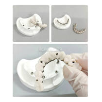 Maxillary Implant Restoration Model M6023 (Opaque Version)