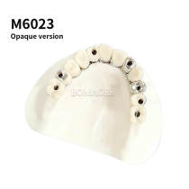 Maxillary Implant Restoration Model M6023 (Opaque Version)