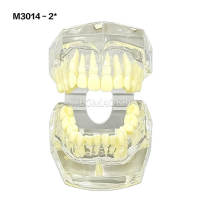 #2 Transparent Malocclusion Orthodontic Demonstration Model M3014