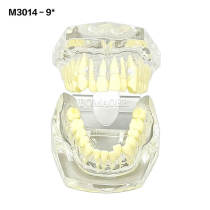 #9 Transparent Malocclusion Orthodontic Demonstration Model M3014