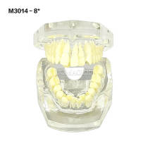 #8 Transparent Malocclusion Orthodontic Demonstration Model M3014