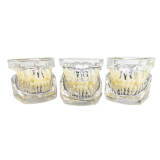 Transparent 10-in-1 Malocclusion Correction Demonstration Model M3014
