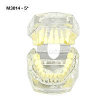 #5 Transparent Malocclusion Orthodontic Demonstration Model M3014