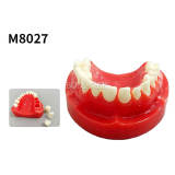 M8027 Dental Half Arch Porcelain Crown Preparation Demonstration Typodont Model