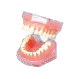 Red Standard Typodont Model M7008 (Original 4004), Removable Soft Teeth Dental Extraction Training