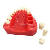 M8027 Dental Half Arch Porcelain Crown Preparation Demonstration Typodont Model