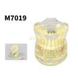 M7019 Pediatric Mixed Dentition Model Early Primary Tooth Loss & Space Maintainer Demonstration Typodont