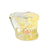 M7019 Pediatric Mixed Dentition Model Early Primary Tooth Loss & Space Maintainer Demonstration Typodont