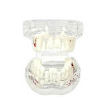 Transparent Mixed Dentition Model M7015, Kids Primary & Permanent Teeth Transition Dental Teaching Typodont