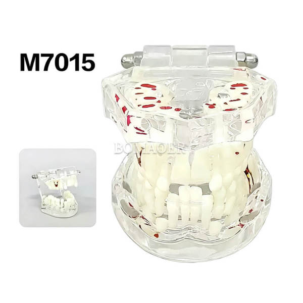 Transparent Mixed Dentition Model M7015, Kids Primary & Permanent Teeth Transition Dental Teaching Typodont