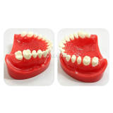 M8027 Dental Half Arch Porcelain Crown Preparation Demonstration Typodont Model