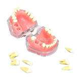 Red Standard Typodont Model M7008 (Original 4004), Removable Soft Teeth Dental Extraction Training