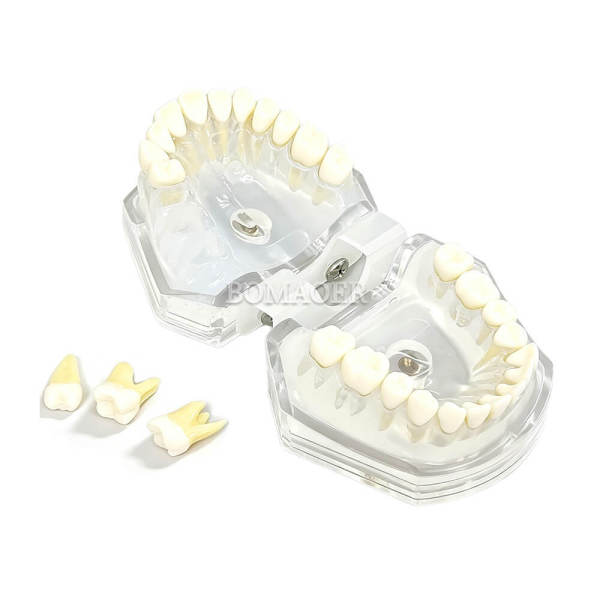Adult Tooth Extraction Standard Typodont Model Transparent Clear Removable Soft Teeth Dental Training Study (M7008/4004)