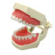 M8011 Standard Dental Model, 28 Screw-Fixed Teeth Demonstration Model