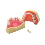 M7009 Pediatric Extractable Teeth Standard Typodont Model