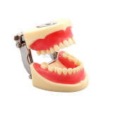 Extraction Practice Typodont Model M8016, 32 Screw-Fixed Teeth