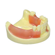 Yellow Mandibular Dental Implant Practice Model